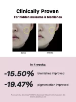 COSRX The Niacinamide 15 Serum - 20ml - Image 9