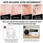 Vibrant Glamour Salicylic Acid Acne Soap - 100g - Image 6