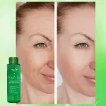 Beauty Obsession Miracle Toner - 150ml - Image 6