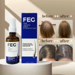 FEG Hair Growth Spray Prevent Hair Loss - 50ml - Image 2