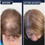 FEG Hair Growth Spray Prevent Hair Loss - 50ml - Image 6