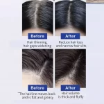 FEG Hair Growth Spray Prevent Hair Loss - 50ml - Image 10