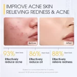 Skinever Salicylic Acid Acne Treatment Ice Sleep Masque - 75ml - Image 3