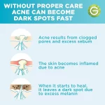 Garnier Skinactive Fast Clear Booster Face Serum - 15ml - Image 8