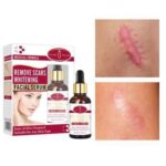 Remove Scars Whitening Facial Serum 30ml - Aichun Beauty - Image 3