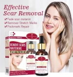 Remove Scars Whitening Facial Serum 30ml - Aichun Beauty