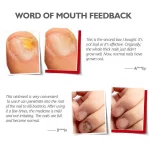 Vibrant Glamour Nail Repair Cream Anti Fungal Nails Repair Nourishing- 20g - Image 6