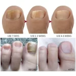 Vibrant Glamour Nail Repair Cream Anti Fungal Nails Repair Nourishing- 20g - Image 8