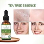 Aichun beauty tea tree oil 30ml - Image 3