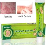 Treatment Psoriasis Eczema Cream Antibacterial Antipruritic Dermatitis Herbal Ointment Anti-Itch Medical Plaster Suitable for skin eczema, diaper rash, milk rash, mosquito bites, skin allergies - Image 3