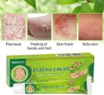 Treatment Psoriasis Eczema Cream Antibacterial Antipruritic Dermatitis Herbal Ointment Anti-Itch Medical Plaster Suitable for skin eczema, diaper rash, milk rash, mosquito bites, skin allergies - Image 4