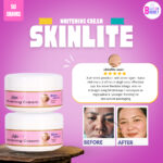 Skinlite whitening cream - Image 2