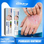 South moon psoriasis ointment